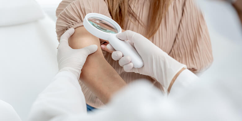 Dermatologin Untersucht Hautveränderung Mit Lupe