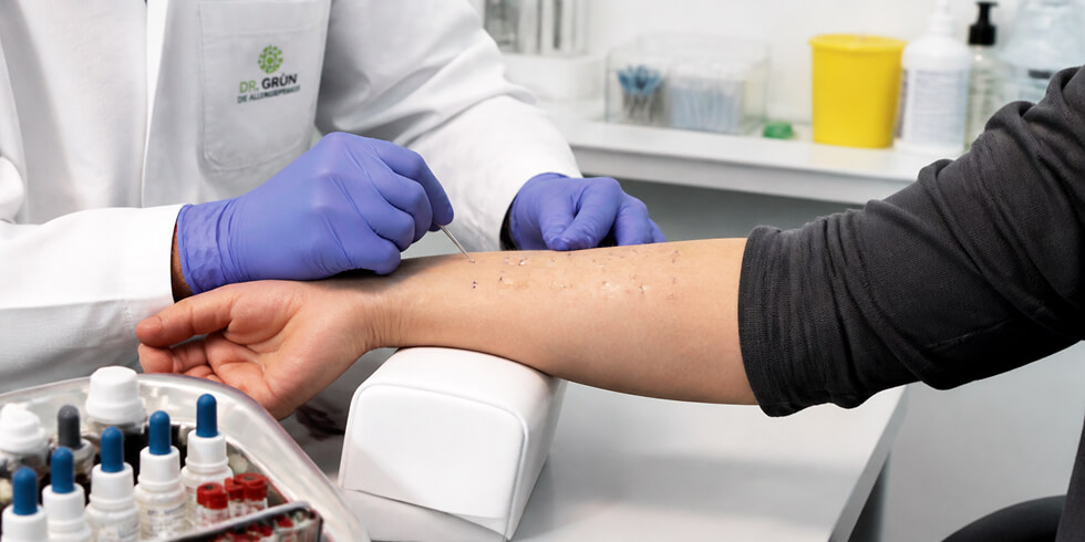 Arzt Führt Prick Test Am Unterarm Durch